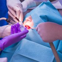 Chirurgia Dentale