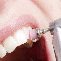 Igiene e prevenzione dentale